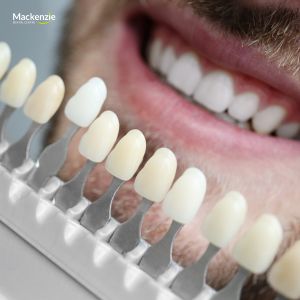 Veneers vs. Other Cosmetic Procedures